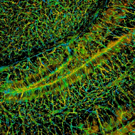 A mouse brain slice.
