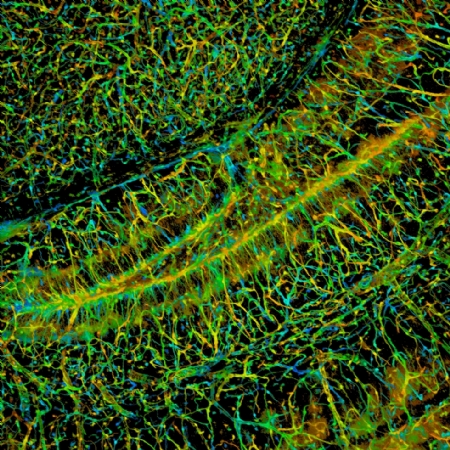 A mouse brain slice.